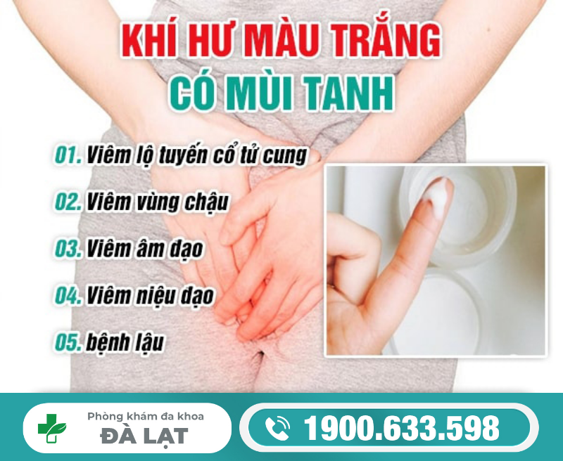 Hình ảnh minh họa